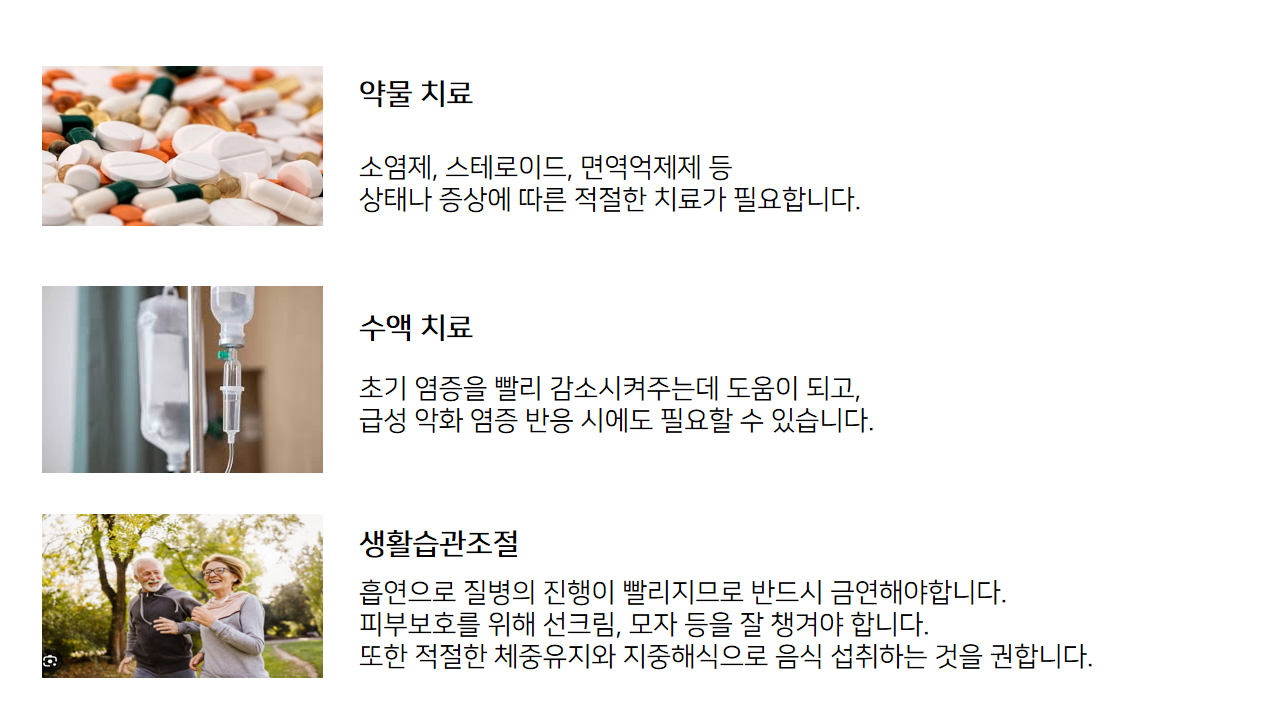 루푸스 치료.png